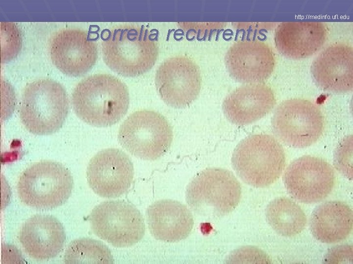 http: //medinfo. ufl. edu Borrelia recurrentis 