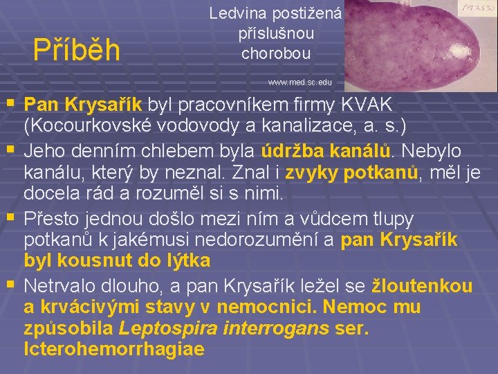 Příběh Ledvina postižená příslušnou chorobou www. med. sc. edu § Pan Krysařík byl pracovníkem