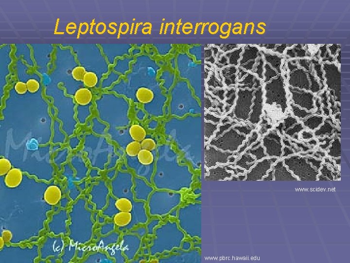 Leptospira interrogans www. scidev. net www. pbrc. hawaii. edu 