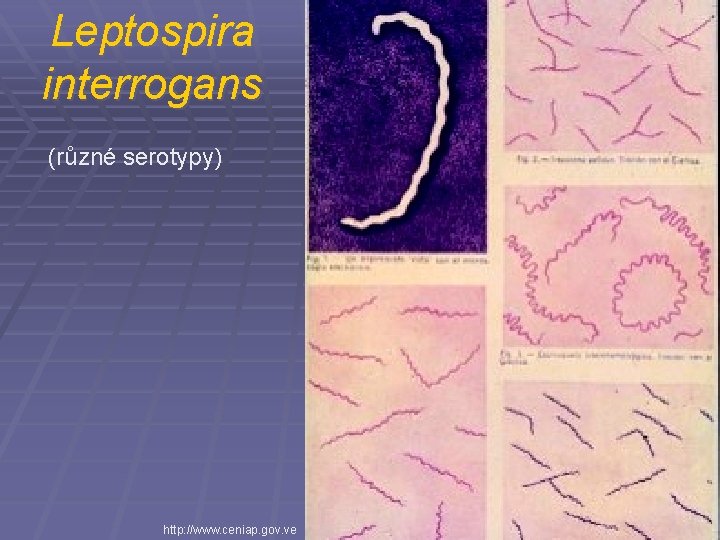 Leptospira interrogans (různé serotypy) http: //www. ceniap. gov. ve 