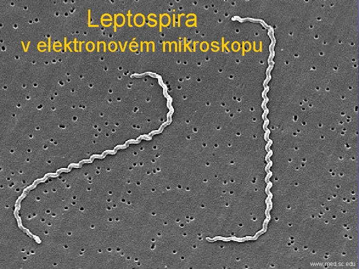 Leptospira v elektronovém mikroskopu www. med. sc. edu 