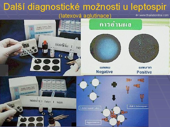 Další diagnostické možnosti u leptospir (latexová aglutinace) 4× www. thailabonline. com 