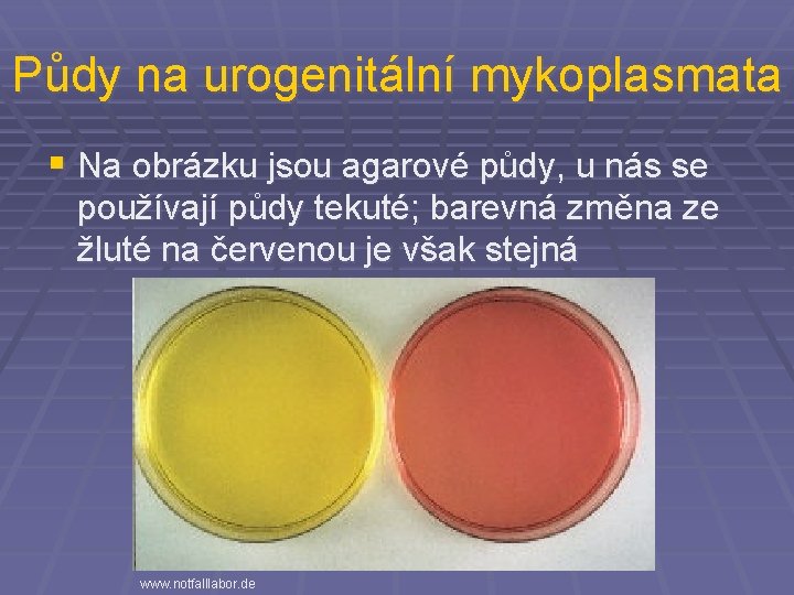 Půdy na urogenitální mykoplasmata § Na obrázku jsou agarové půdy, u nás se používají