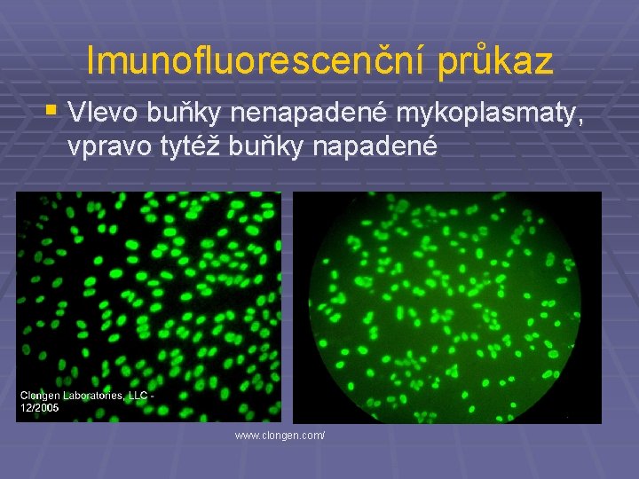 Imunofluorescenční průkaz § Vlevo buňky nenapadené mykoplasmaty, vpravo tytéž buňky napadené www. clongen. com/