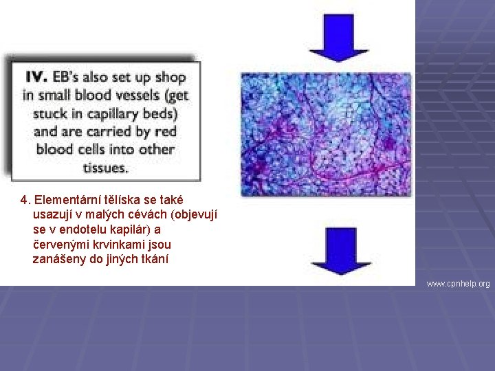 4. Elementární tělíska se také usazují v malých cévách (objevují se v endotelu kapilár)