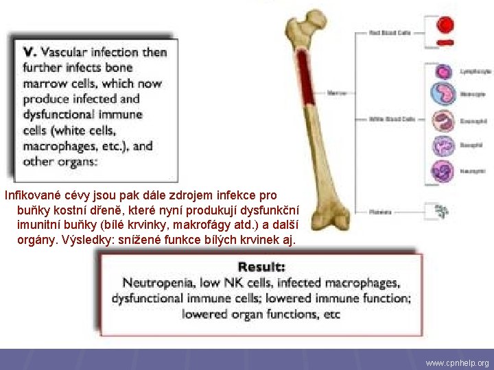 Infikované cévy jsou pak dále zdrojem infekce pro buňky kostní dřeně, které nyní produkují