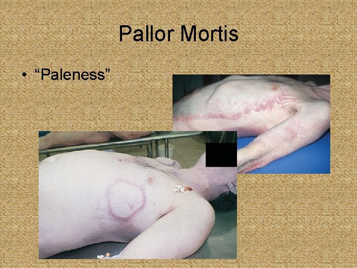 Pallor Mortis • “Paleness” 