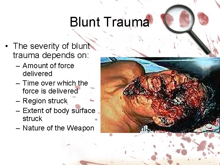 Blunt Trauma • The severity of blunt trauma depends on: – Amount of force