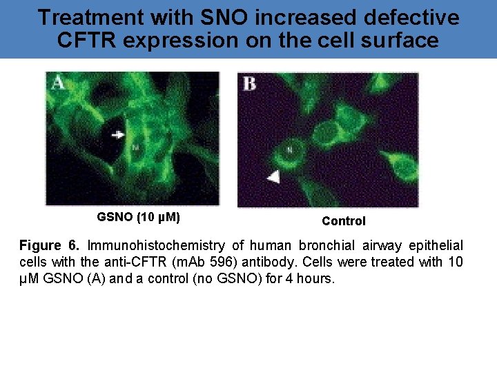 Treatment with SNO increased defective CFTR expression on the cell surface GSNO (10 µM)