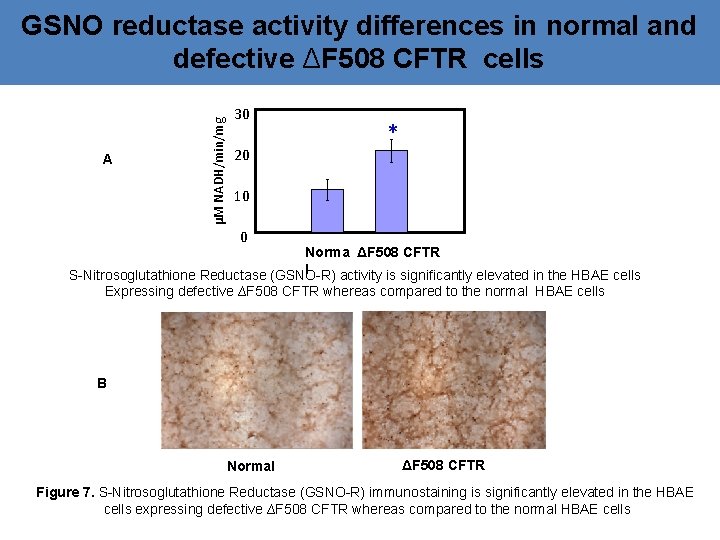 A µM NADH/min/mg GSNO reductase activity differences in normal and defective ΔF 508 CFTR