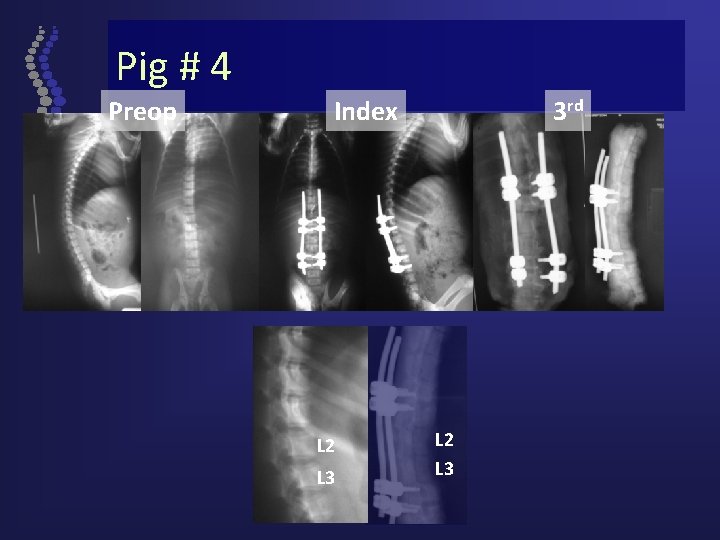 Pig # 4 Preop Index L 2 L 3 3 rd L 2 L