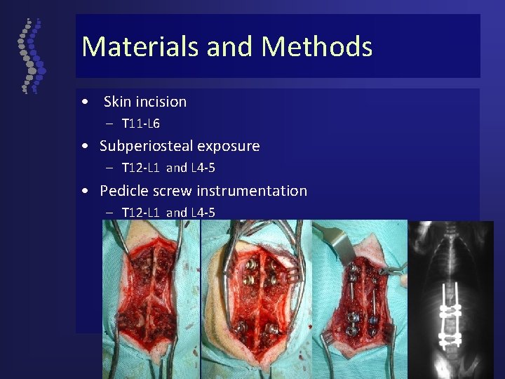 Materials and Methods • Skin incision – T 11 -L 6 • Subperiosteal exposure