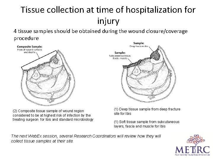 Tissue collection at time of hospitalization for injury 4 tissue samples should be obtained