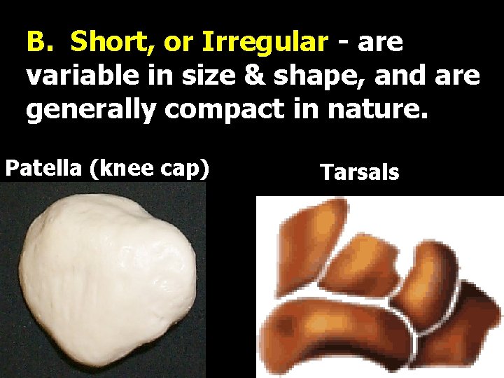 B. Short, or Irregular - are variable in size & shape, and are generally