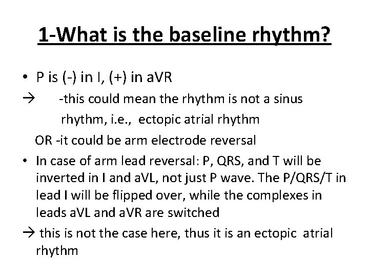 1 -What is the baseline rhythm? • P is (-) in I, (+) in