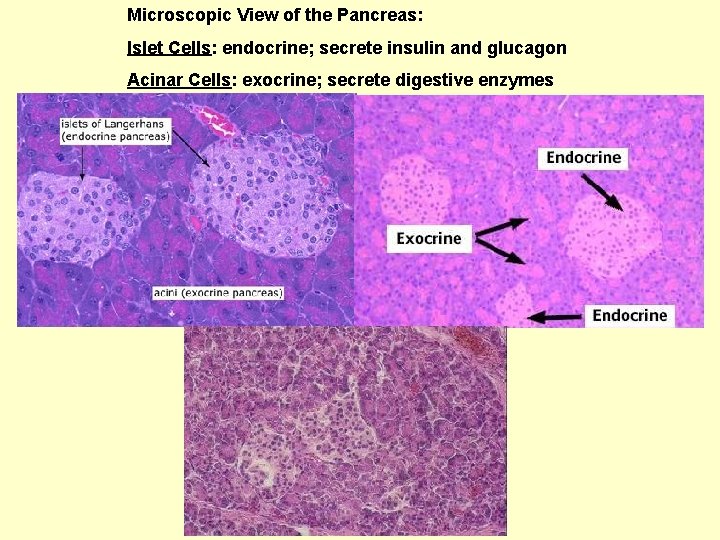 Microscopic View of the Pancreas: Islet Cells: endocrine; secrete insulin and glucagon Acinar Cells: