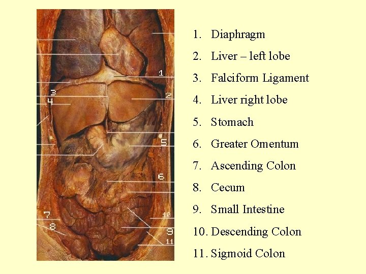 1. Diaphragm 2. Liver – left lobe 3. Falciform Ligament 4. Liver right lobe