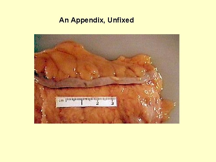  An Appendix, Unfixed 