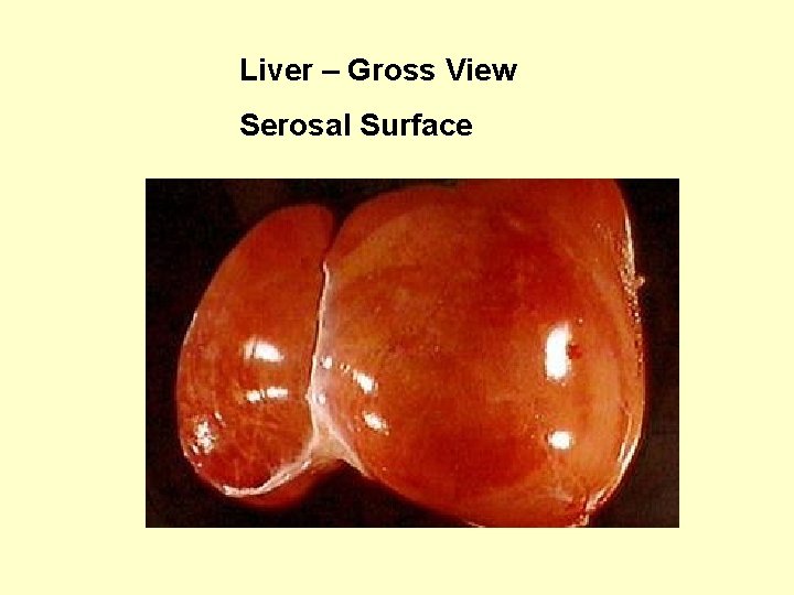 Liver – Gross View Serosal Surface 