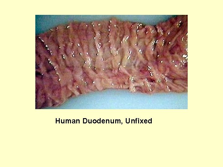  Human Duodenum, Unfixed 