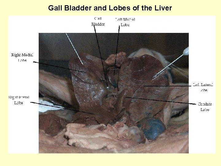  Gall Bladder and Lobes of the Liver 