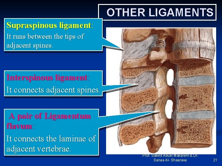 OTHER LIGAMENTS Supraspinous ligament: It runs between the tips of adjacent spines. Interspinous ligament: