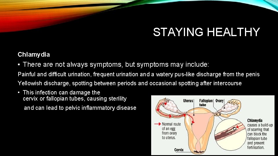 STAYING HEALTHY Chlamydia • There are not always symptoms, but symptoms may include: Painful