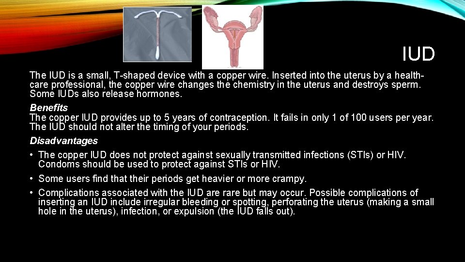 IUD The IUD is a small, T-shaped device with a copper wire. Inserted into