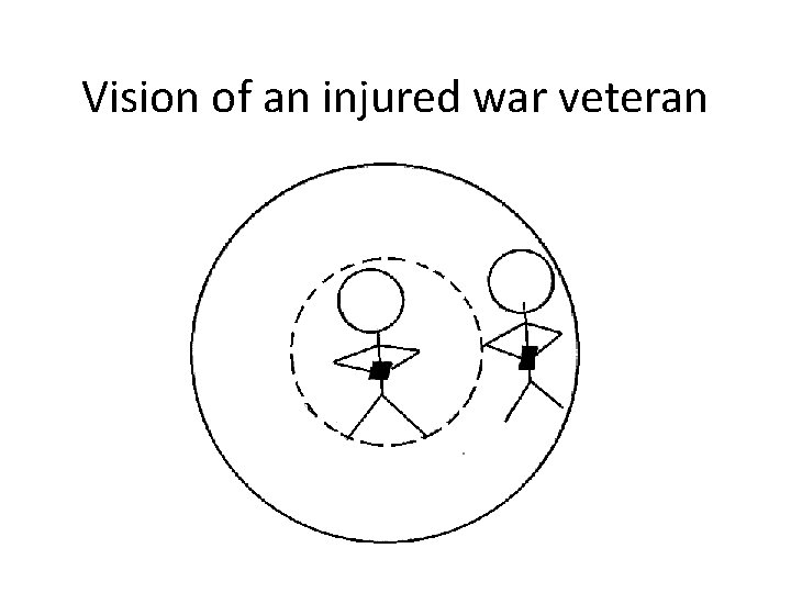 Vision of an injured war veteran 