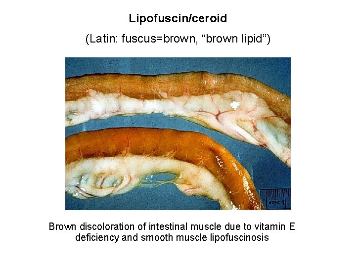 Lipofuscin/ceroid (Latin: fuscus=brown, “brown lipid”) Brown discoloration of intestinal muscle due to vitamin E