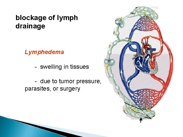 blockage of lymph drainage Lymphedema - swelling in tissues - due to tumor pressure,