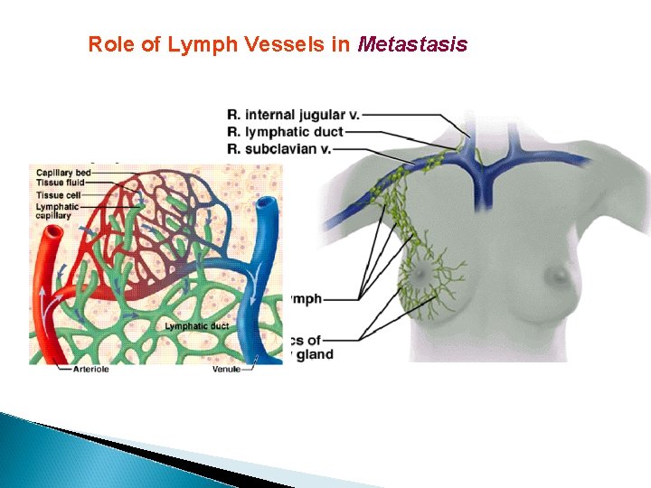 Role of Lymph Vessels in Metastasis 