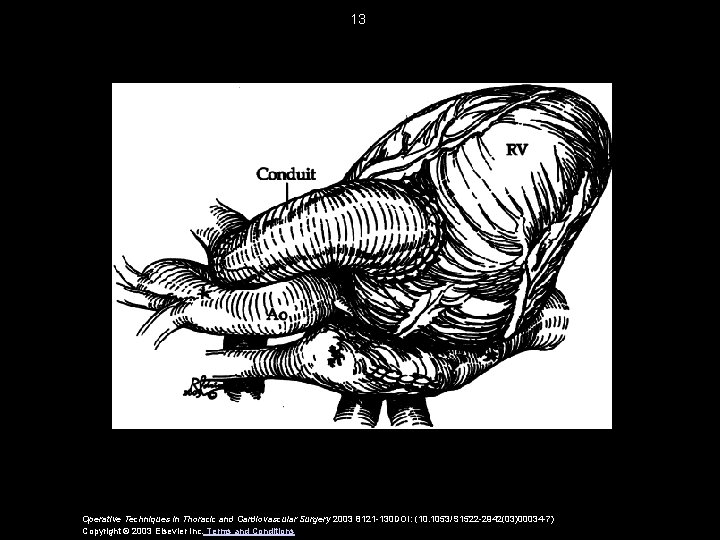 13 Operative Techniques in Thoracic and Cardiovascular Surgery 2003 8121 -130 DOI: (10. 1053/S