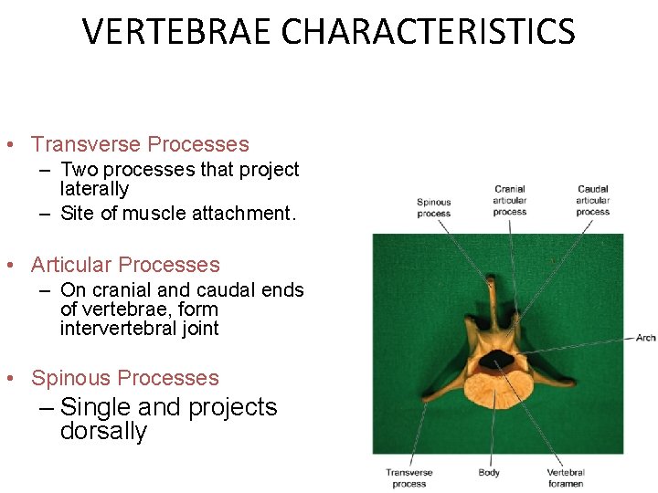 VERTEBRAE CHARACTERISTICS • Transverse Processes – Two processes that project laterally – Site of