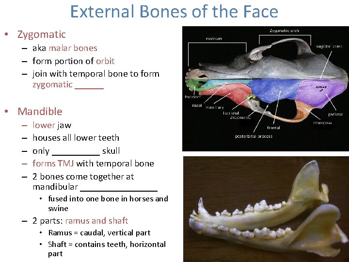 External Bones of the Face • Zygomatic – aka malar bones – form portion