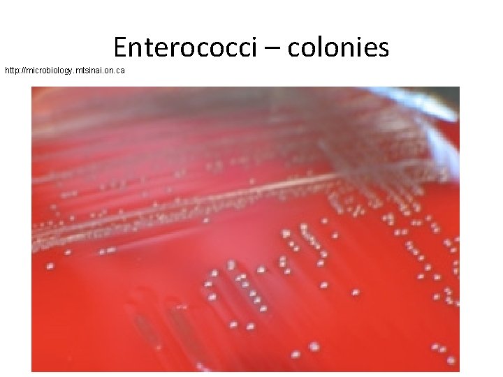 Enterococci – colonies http: //microbiology. mtsinai. on. ca 