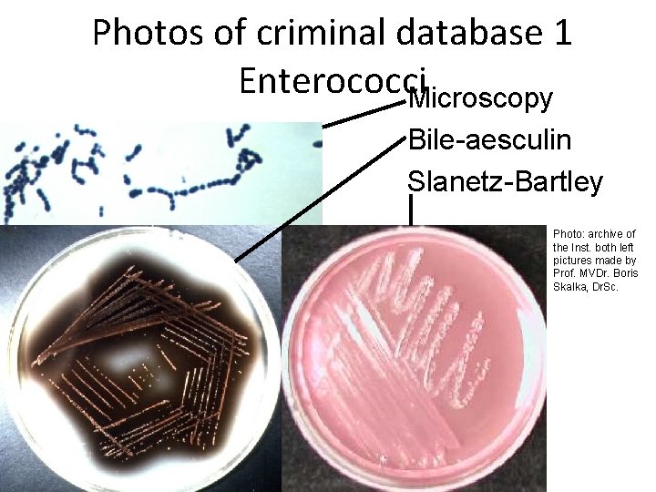 Photos of criminal database 1 Enterococci Microscopy Bile-aesculin Slanetz-Bartley Photo: archive of the Inst.