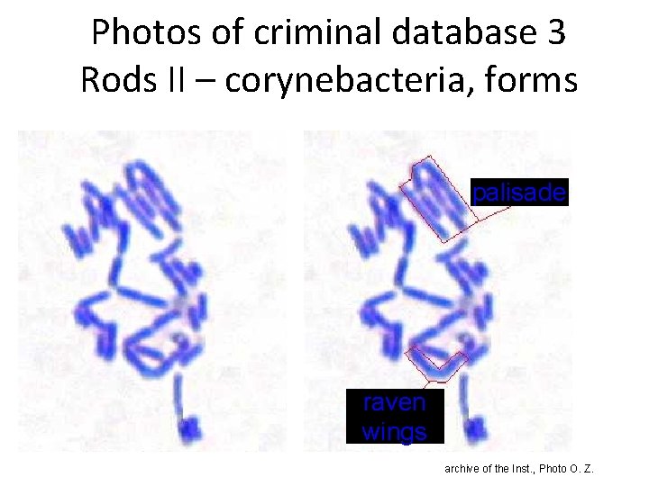 Photos of criminal database 3 Rods II – corynebacteria, forms palisade raven wings archive