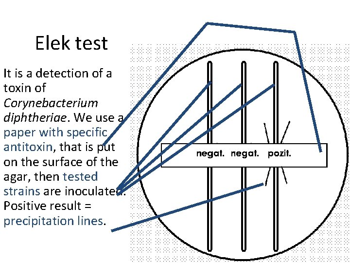 Elek test It is a detection of a toxin of Corynebacterium diphtheriae. We use