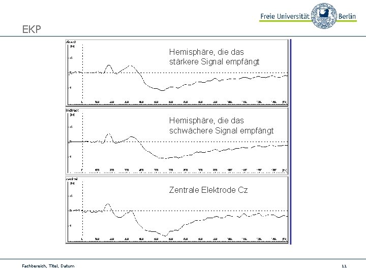 EKP Hemisphäre, die das stärkere Signal empfängt Hemisphäre, die das schwächere Signal empfängt Zentrale