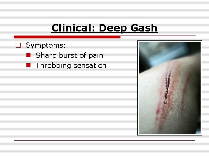 Clinical: Deep Gash o Symptoms: n Sharp burst of pain n Throbbing sensation 