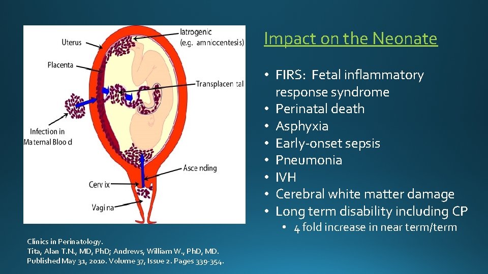 Impact on the Neonate • FIRS: Fetal inflammatory response syndrome • Perinatal death •