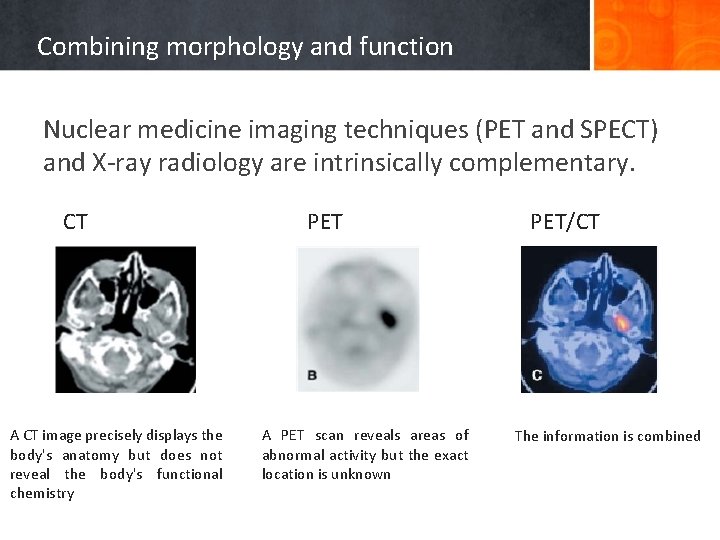 Combining morphology and function Nuclear medicine imaging techniques (PET and SPECT) and X-ray radiology
