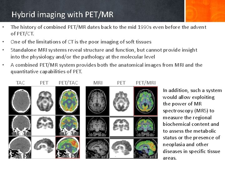 Hybrid imaging with PET/MR • • The history of combined PET/MR dates back to