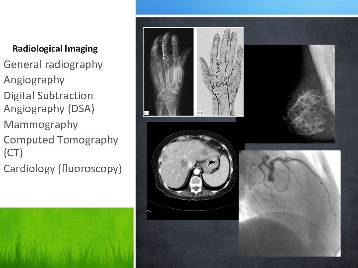 Radiological Imaging General radiography Angiography Digital Subtraction Angiography (DSA) Mammography Computed Tomography (CT) Cardiology