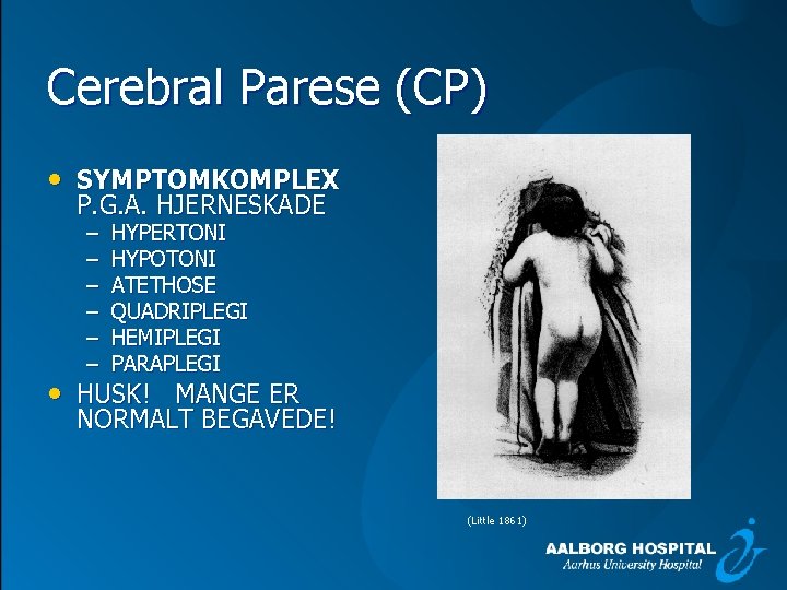 Cerebral Parese (CP) • SYMPTOMKOMPLEX P. G. A. HJERNESKADE – – – HYPERTONI HYPOTONI