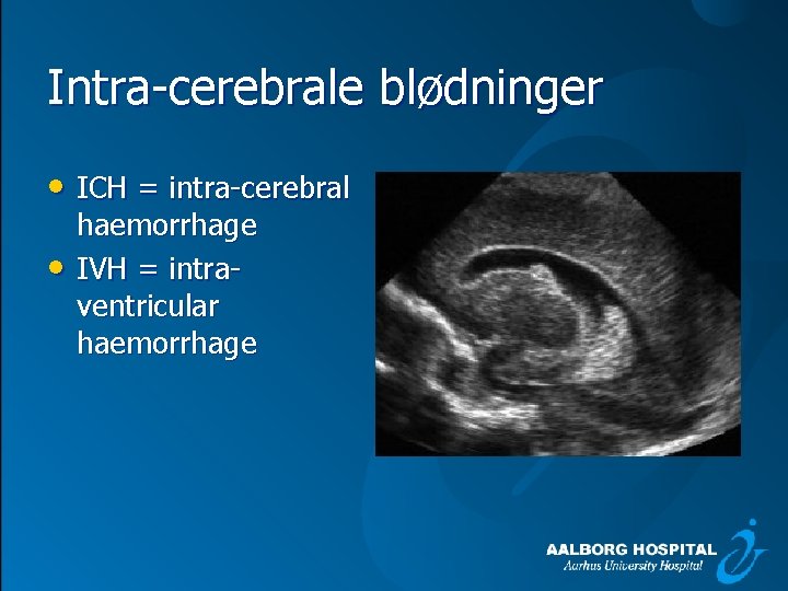 Intra cerebrale blødninger • ICH = intra cerebral • haemorrhage IVH = intra ventricular