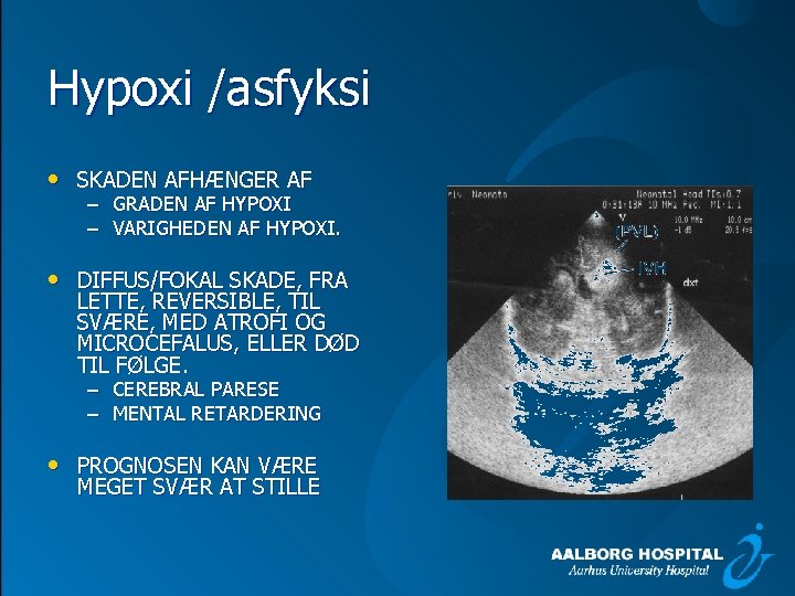 Hypoxi /asfyksi • SKADEN AFHÆNGER AF – GRADEN AF HYPOXI – VARIGHEDEN AF HYPOXI.