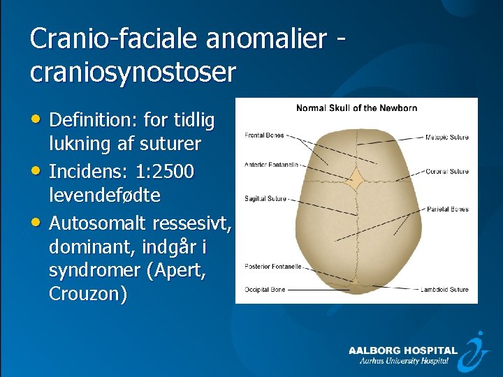 Cranio faciale anomalier craniosynostoser • Definition: for tidlig • • lukning af suturer Incidens: