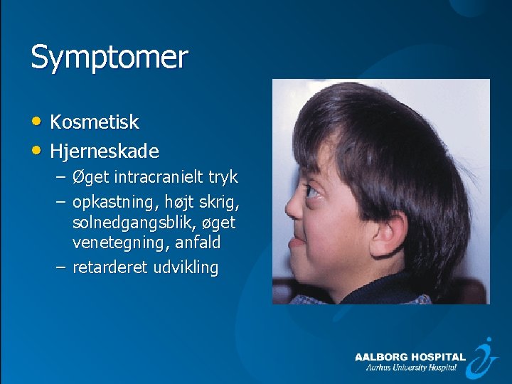 Symptomer • Kosmetisk • Hjerneskade – Øget intracranielt tryk – opkastning, højt skrig, solnedgangsblik,